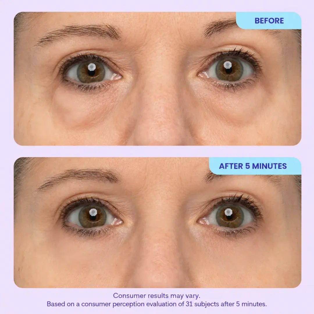 Dexalt Instant Lift Eye Gel – Anti-Puffiness, Dark Circles & Wrinkles