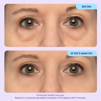 Dexalt Instant Lift Eye Gel – Anti-Puffiness, Dark Circles & Wrinkles